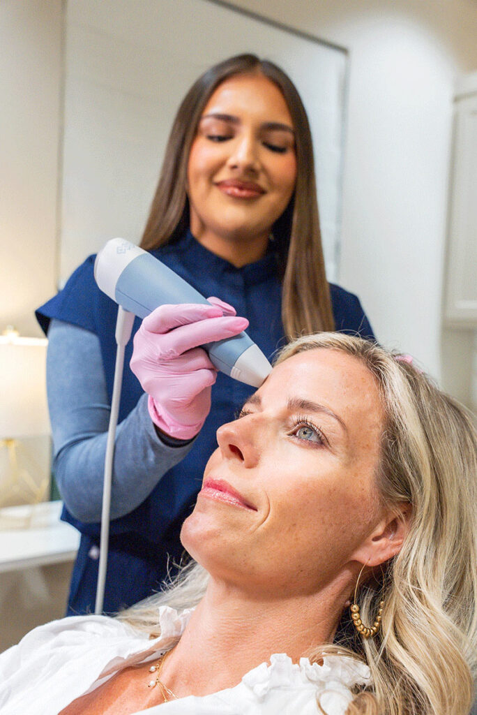 Exion Fractional RF treatment