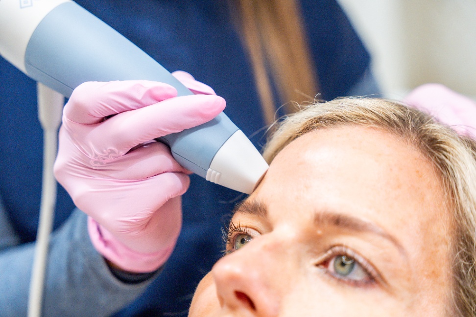 microneedling tyler tx