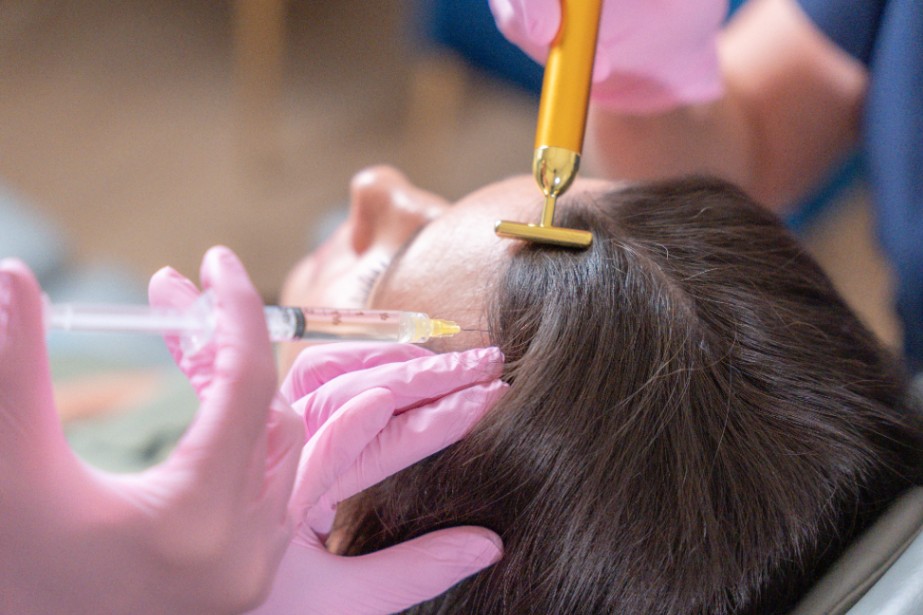 hair restoration tyler tx