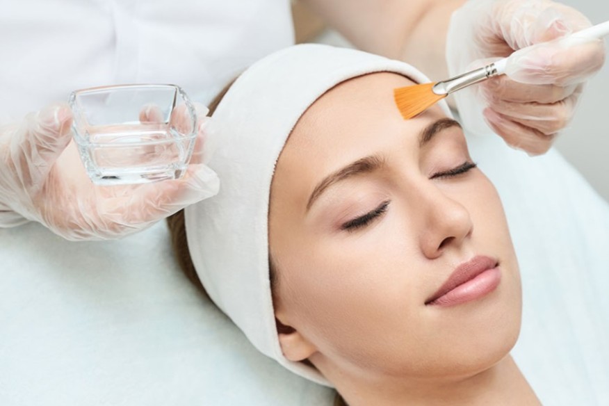 chemical peel tyler tx