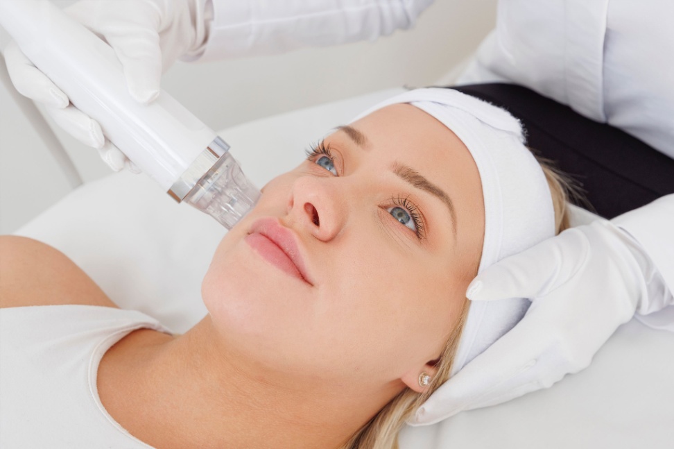 rf microneedling